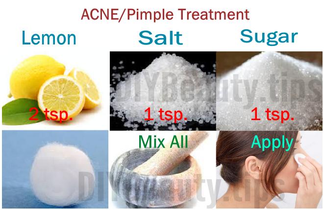 Acne & Pimple Treatment