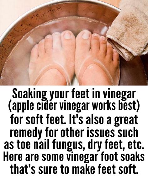 Soaking feet in vinegar for soft feet...